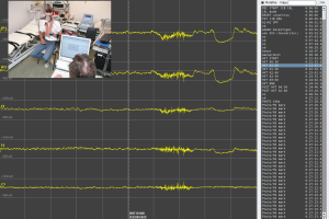 EDFbrowser screenshot